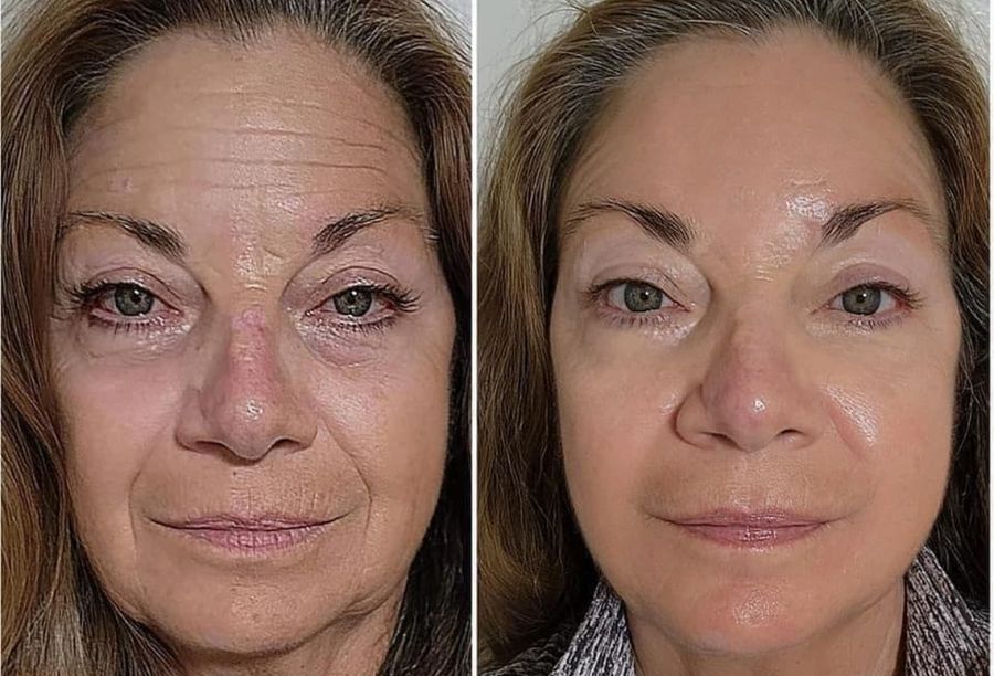 Before / After
